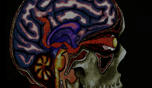 These_things_in_my_head_-_side_a_1