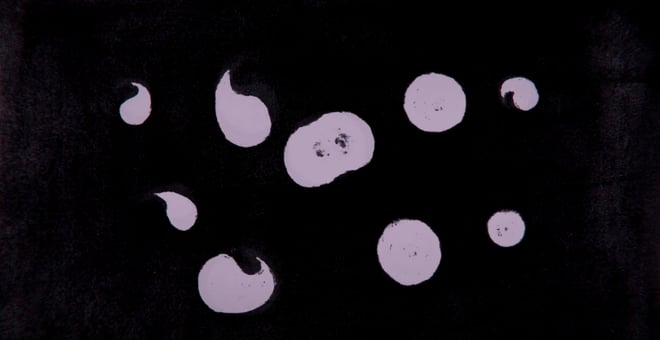 Adhesion_2